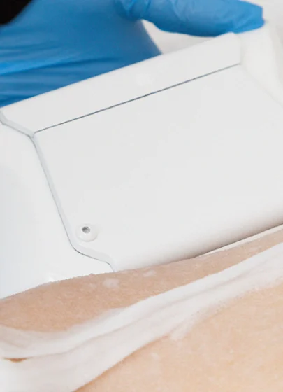 Cryo Lipoliz (Soğuk Yağ Dondurma) Uygulaması