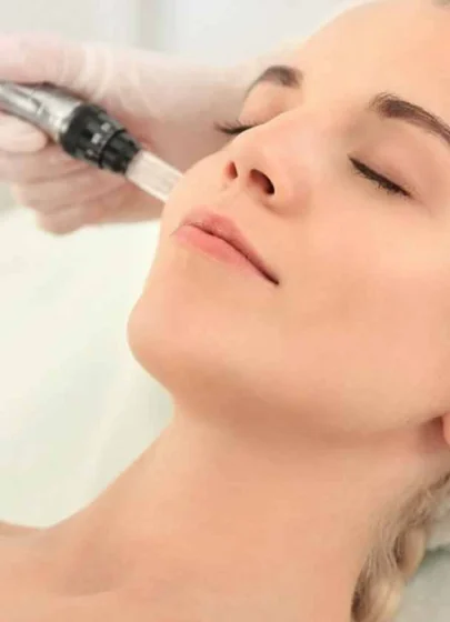 Dermapen Cilt Yenileme Uygulaması