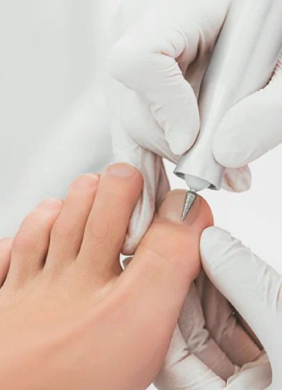 Medikal Ayak Bakımı (Profesyonel Ayak Sağlığı ve Terapik Bakım)